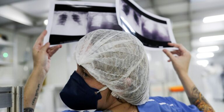 Diagnóstico tardio dá poucas chances de cura para o câncer de pulmão diagnostico-tardio-da-poucas-chances-de-cura-para-o-cancer-de-pulmao