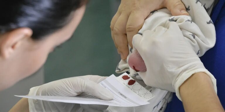 Atraso na ampliação do teste do pezinho dificulta diagnóstico da AME atraso-na-ampliacao-do-teste-do-pezinho-dificulta-diagnostico-da-ame