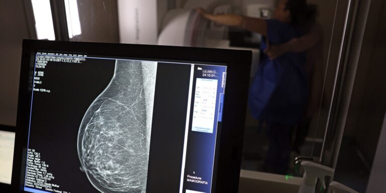 Plano de saúde terá que cobrir mamografia digital para todas as idades plano-de-saude-tera-que-cobrir-mamografia-digital-para-todas-as-idades